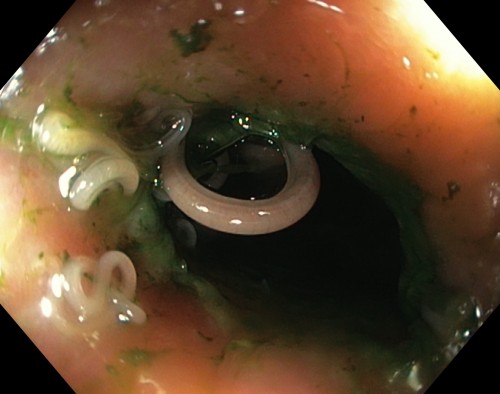 Endocope image of a Shag with worms down its esophagus